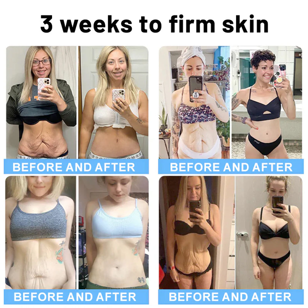 Flysmus® Skin Firming Cream,Addressing Crepe & Sagging AU
