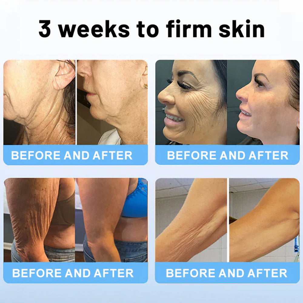 Flysmus® Skin Firming Cream,Addressing Crepe & Sagging AU