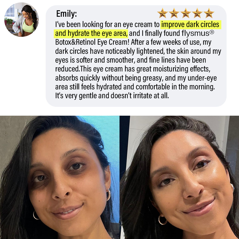 ✅Official Store | flysmus® Botox Retinol Eye Cream 🧑🏼⚕️Dermatologist Recommended (Eye Cream for Fine Lines, Wrinkles, Dark Circles, Dark Spots, and Daily Anti-Aging)