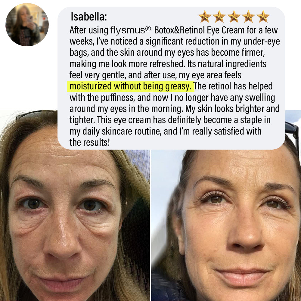 ✅Official Store | flysmus® Botox Retinol Eye Cream 🧑🏼⚕️Dermatologist Recommended (Eye Cream for Fine Lines, Wrinkles, Dark Circles, Dark Spots, and Daily Anti-Aging)