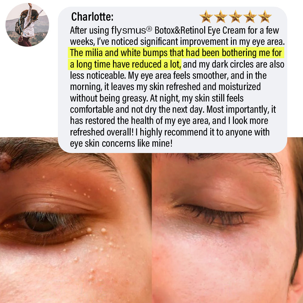 ✅Official Store | flysmus® Botox Retinol Eye Cream 🧑🏼⚕️Dermatologist Recommended (Eye Cream for Fine Lines, Wrinkles, Dark Circles, Dark Spots, and Daily Anti-Aging)