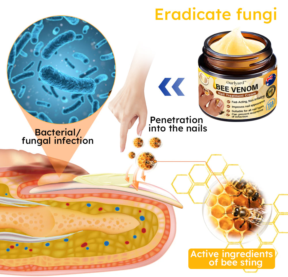 Ourlyard™ Bee Venom Nail Fungus Treatment Solution:Completely solve the nail fungus problem👣