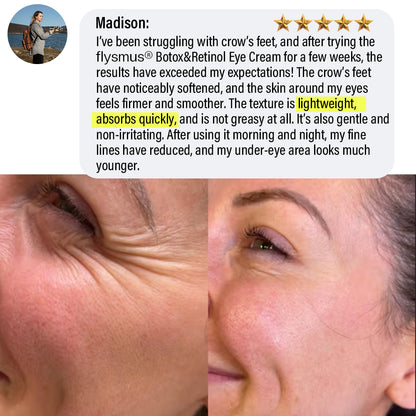 ✅Official Store | flysmus® Botox Retinol Eye Cream 🧑🏼‍⚕️Dermatologist Recommended (Eye Cream for Fine Lines, Wrinkles, Dark Circles, Dark Spots, and Daily Anti-Aging)🍀🍀
