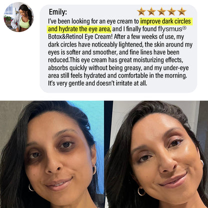 ✅Official Store | flysmus® Botox Retinol Eye Cream 🧑🏼‍⚕️Dermatologist Recommended (Eye Cream for Fine Lines, Wrinkles, Dark Circles, Dark Spots, and Daily Anti-Aging)🍀🍀